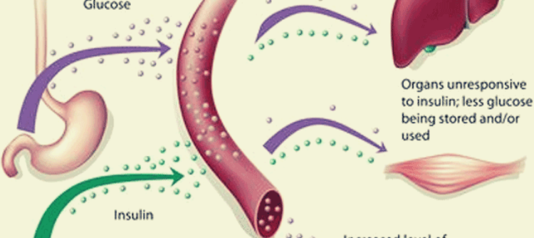 Infertility And Diabetes