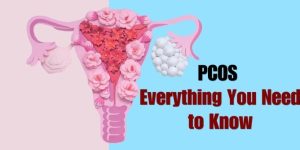 PCOS