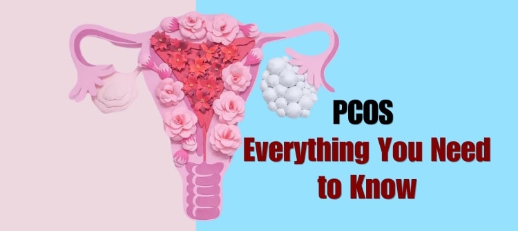 PCOS