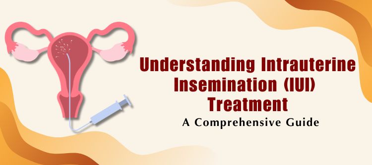 Intrauterine Insemination (IUI Treatment