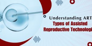 Assisted Reproductive Technologies