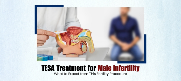 Male Infertility Treatment