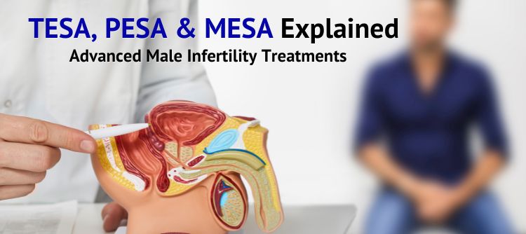 Advanced Male Infertility Treatments
