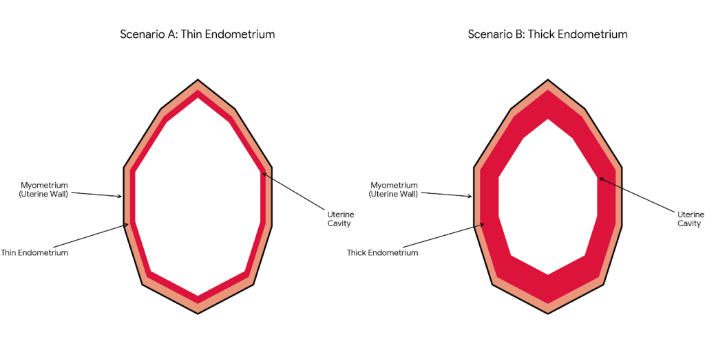 What is Thin vs Thick Endometrium